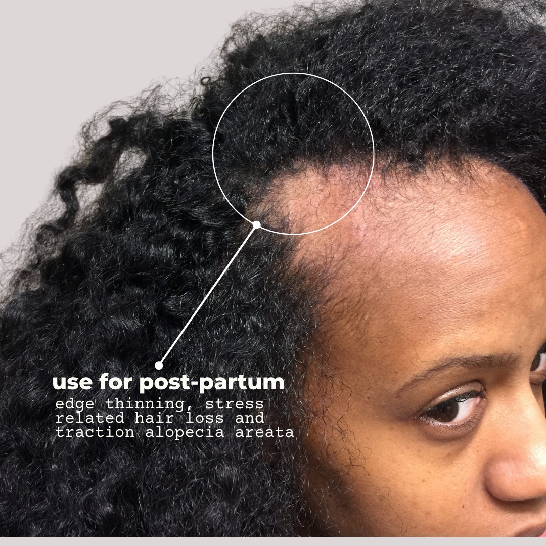 Trusse Beauty Gud Scalp & Hair Health and Maintenance Serum Bundle